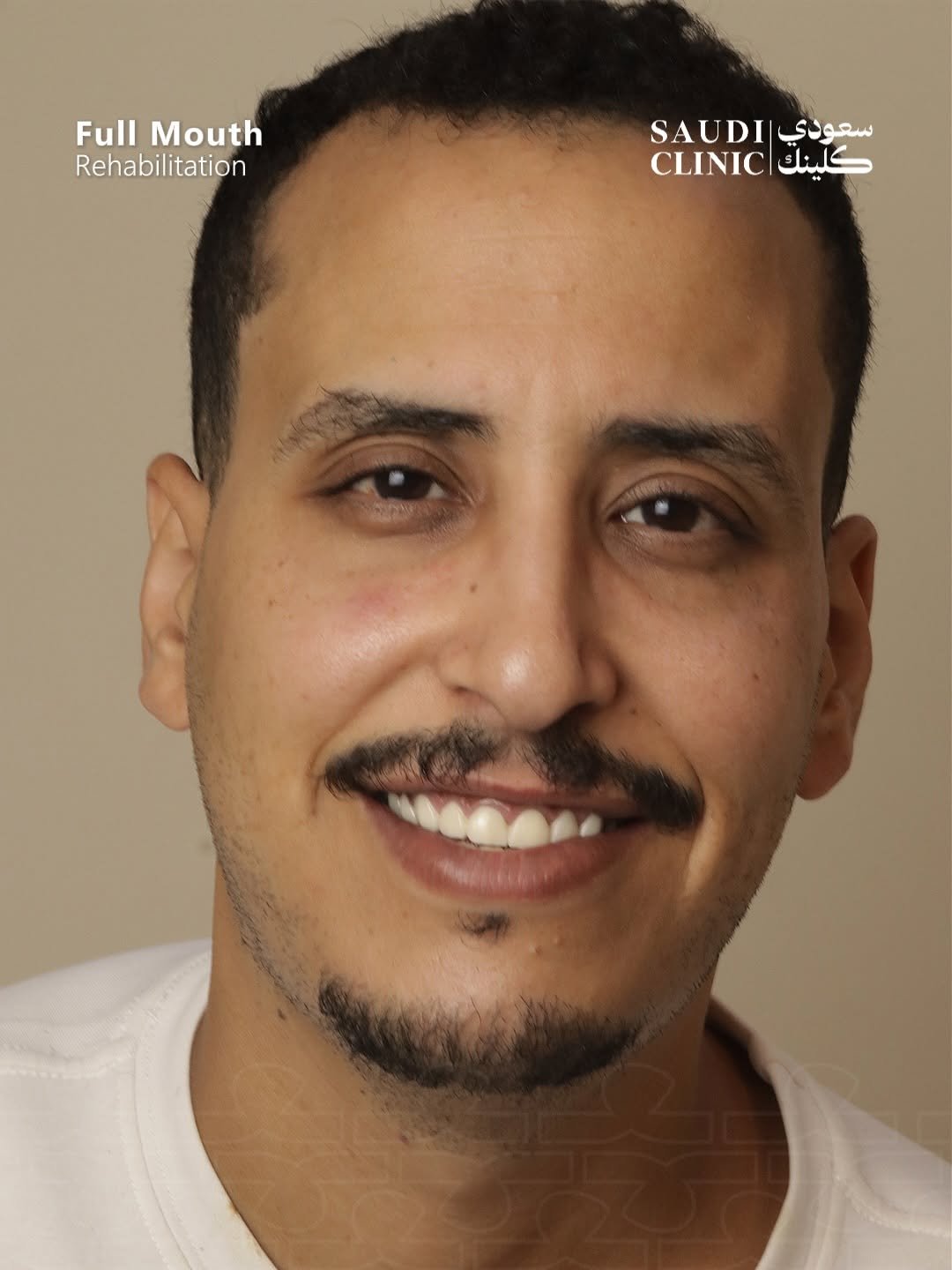 بعد