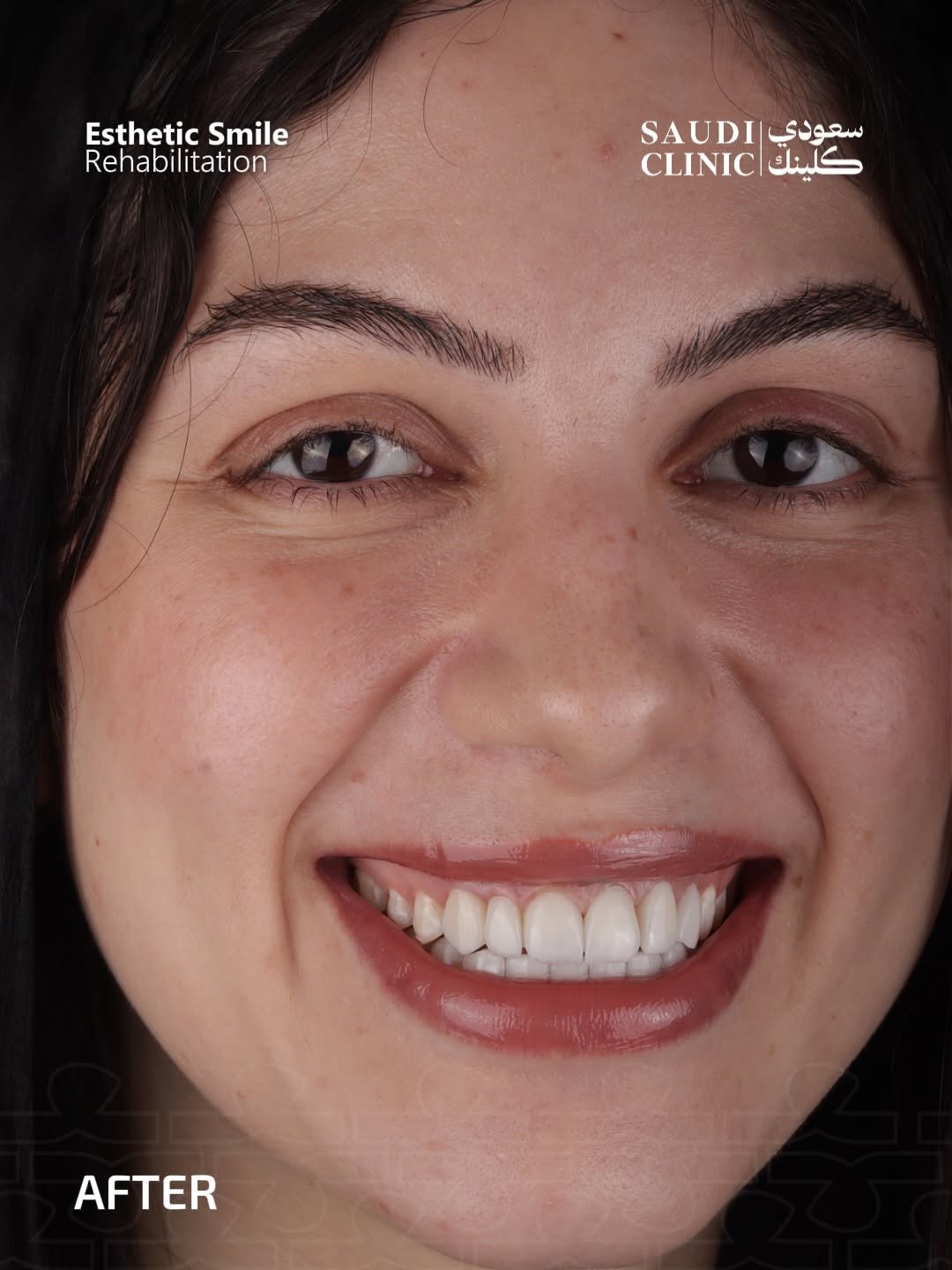 بعد
