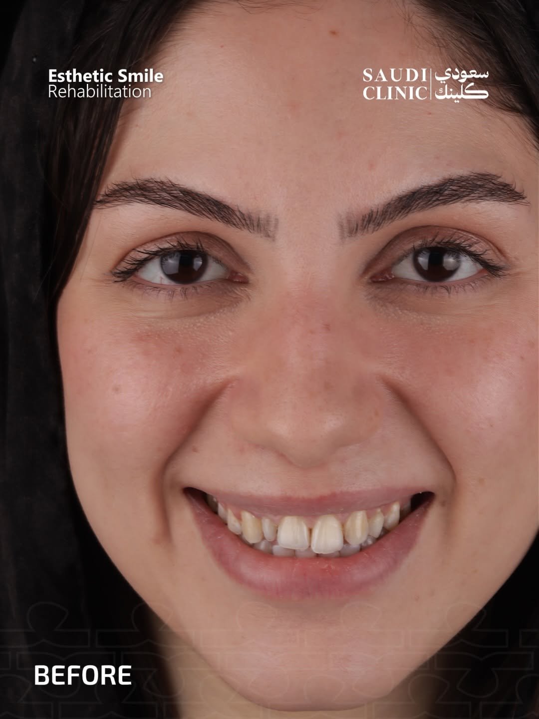 قبل