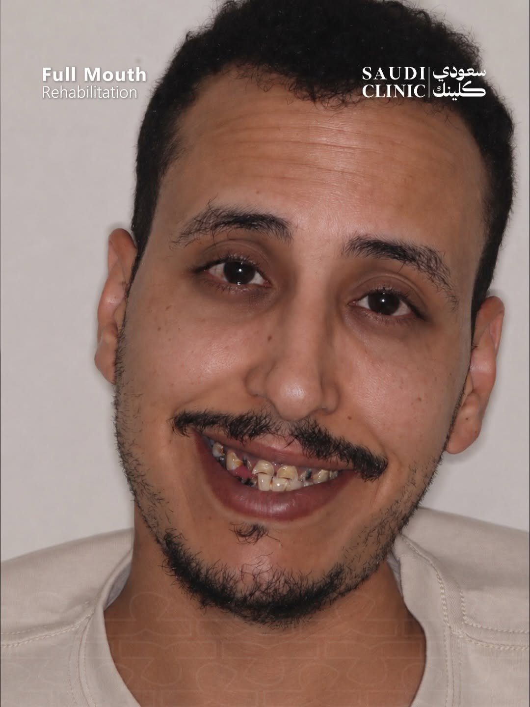 قبل